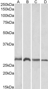 SIAH1 Antibody - Goat Anti-SIAH1 Antibody (1µg/ml) staining of Mouse (A, C) and Rat (B, D) Brain (A, B) and Liver (C, D) lysates (35µg protein in RIPA buffer). Detected by chemiluminescencence.
