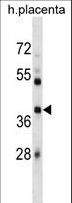 SIAH1 Antibody - SIAH1 Antibody western blot of human placenta tissue lysates (35 ug/lane). The SIAH1 antibody detected the SIAH1 protein (arrow).