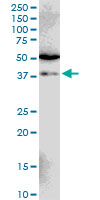 SIAH1 Antibody - SIAH1 monoclonal antibody (M02), clone 2C5. Western Blot analysis of SIAH1 expression in Jurkat.