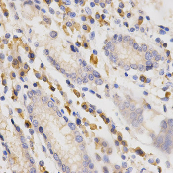 SIAH1 Antibody - Immunohistochemistry of paraffin-embedded rat testis using SIAH1 antibody at dilution of 1:200 (x400 lens).