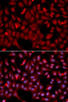 SIAH1 Antibody - Immunofluorescence analysis of U2OS cell using SIAH1 antibody. Blue: DAPI for nuclear staining.