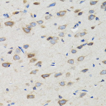 SIAH1 Antibody - Immunohistochemistry of paraffin-embedded rat brain tissue.