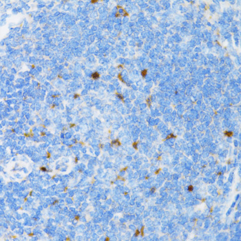 SIAH1 Antibody - Immunohistochemistry of paraffin-embedded rat spleen tissue.