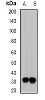 SIAH1 Antibody - Western blot analysis of SIAH1 expression in BT474 (A); mouse kidney (B) whole cell lysates.