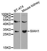 SIAH1 Antibody - Western blot analysis of extracts of various cell lines, using SIAH1 antibody at 1:1000 dilution. The secondary antibody used was an HRP Goat Anti-Rabbit IgG (H+L) at 1:10000 dilution. Lysates were loaded 25ug per lane and 3% nonfat dry milk in TBST was used for blocking.