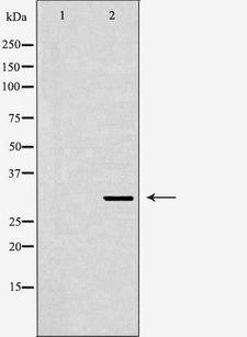 SIAH1 Antibody - Western blot analysis of mouse brain lysate using SIAH1 antibody. The lane on the left is treated with the antigen-specific peptide.