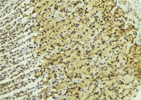 SIAH1 Antibody - 1:100 staining human gastric tissue by IHC-P. The sample was formaldehyde fixed and a heat mediated antigen retrieval step in citrate buffer was performed. The sample was then blocked and incubated with the antibody for 1.5 hours at 22°C. An HRP conjugated goat anti-rabbit antibody was used as the secondary.