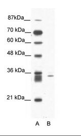 SIAH1 Antibody - A: Marker, B: Jurkat Cell Lysate.  This image was taken for the unconjugated form of this product. Other forms have not been tested.