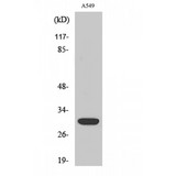 SIAH1/SIAH2 Antibody - Western blot of Siah-1/2 antibody