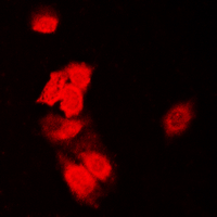 SIAH1/SIAH2 Antibody - Immunofluorescent analysis of SIAH1/2 staining in HeLa cells. Formalin-fixed cells were permeabilized with 0.1% Triton X-100 in TBS for 5-10 minutes and blocked with 3% BSA-PBS for 30 minutes at room temperature. Cells were probed with the primary antibody in 3% BSA-PBS and incubated overnight at 4 C in a humidified chamber. Cells were washed with PBST and incubated with a DyLight 594-conjugated secondary antibody (red) in PBS at room temperature in the dark. DAPI was used to stain the cell nuclei (blue).