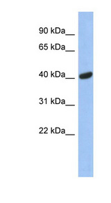 SIAH2 Antibody - SIAH2 antibody Western blot of Fetal Muscle lysate. This image was taken for the unconjugated form of this product. Other forms have not been tested.