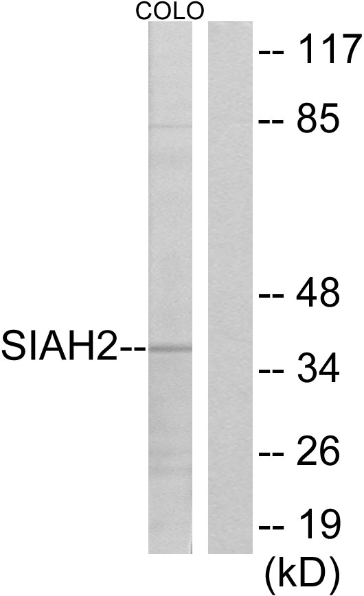 SIAH2 Antibody - Western blot analysis of lysates from COLO cells, using SIAH2 Antibody. The lane on the right is blocked with the synthesized peptide.
