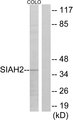 SIAH2 Antibody - Western blot analysis of lysates from COLO cells, using SIAH2 Antibody. The lane on the right is blocked with the synthesized peptide.