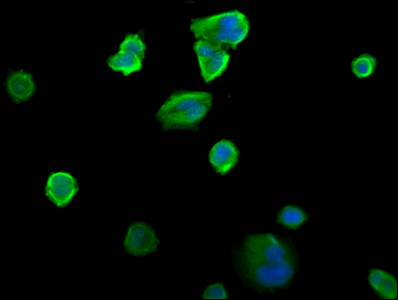 SIAH2 Antibody - Immunofluorescence staining of MCF-7 cells diluted at 1:200, counter-stained with DAPI. The cells were fixed in 4% formaldehyde, permeabilized using 0.2% Triton X-100 and blocked in 10% normal Goat Serum. The cells were then incubated with the antibody overnight at 4°C.The Secondary antibody was Alexa Fluor 488-congugated AffiniPure Goat Anti-Rabbit IgG (H+L).