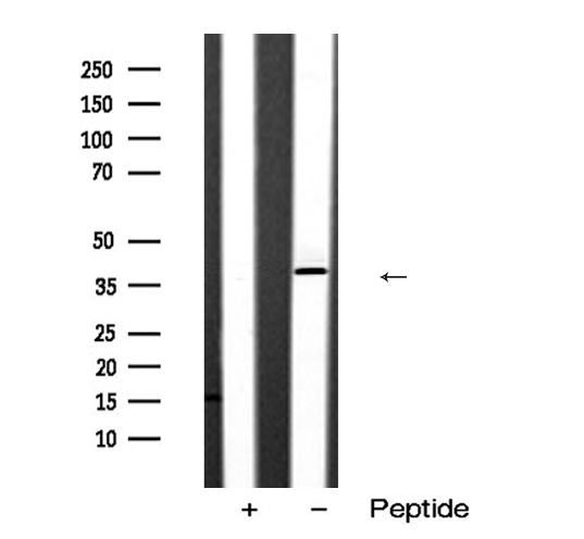 SIAH2 Antibody - Western blot analysis of SIAH2 expression in COLO cells