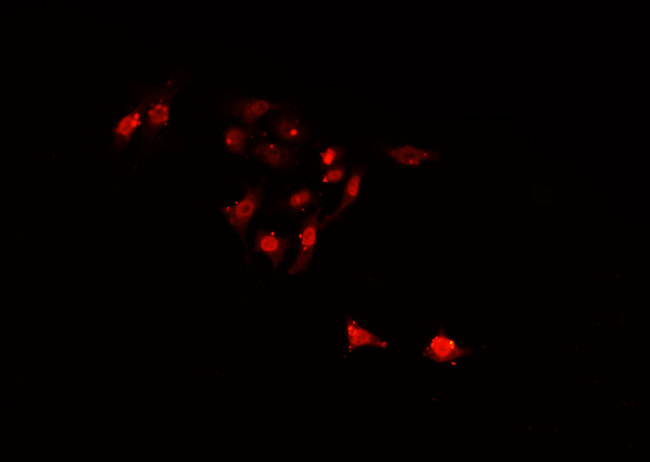 SIAH2 Antibody - Staining HuvEc cells by IF/ICC. The samples were fixed with PFA and permeabilized in 0.1% Triton X-100, then blocked in 10% serum for 45 min at 25°C. The primary antibody was diluted at 1:200 and incubated with the sample for 1 hour at 37°C. An Alexa Fluor 594 conjugated goat anti-rabbit IgG (H+L) Ab, diluted at 1/600, was used as the secondary antibody.