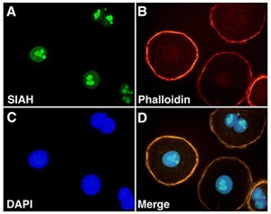 SIAH2 Antibody - SIAH2 Antibody (24E6H3) - Immunofluorescent staining of SIAH in ovarian carcinoma (OVCR3)cells.