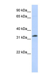 SIAH2 Antibody - SIAH2 antibody Western blot of HeLa lysate. This image was taken for the unconjugated form of this product. Other forms have not been tested.