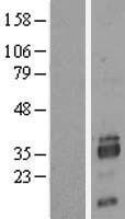 SIAH2 Protein - Western validation with an anti-DDK antibody * L: Control HEK293 lysate R: Over-expression lysate