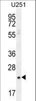 SIAH3 Antibody - SIAH3 Antibody western blot of U251 cell line lysates (35 ug/lane). The SIAH3 antibody detected the SIAH3 protein (arrow).
