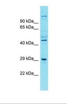 SIAH3 Antibody - Western blot of Fetal Brain. SIAH3 antibody dilution 1.0 ug/ml.  This image was taken for the unconjugated form of this product. Other forms have not been tested.