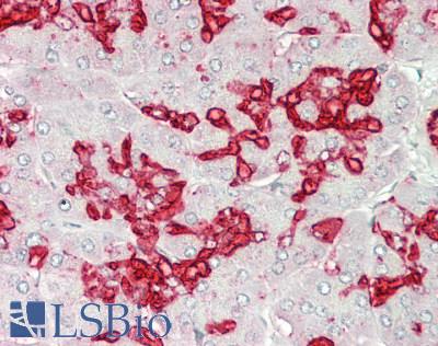 Sialylated Lewis a / CA 19-9 Antibody - Human Pancreas: Formalin-Fixed, Paraffin-Embedded (FFPE)