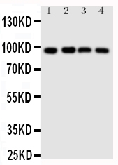 SIDT1 Antibody - Anti-SIDT1 antibody, Western blotting Lane 1: HELA Cell LysateLane 2: COLO320 Cell LysateLane 3: SW620 Cell LysateLane 4: HT1080 Cell Lysate