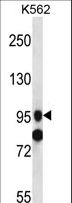 SIDT1 Antibody - SIDT1 Antibody western blot of K562 cell line lysates (35 ug/lane). The SIDT1 antibody detected the SIDT1 protein (arrow).