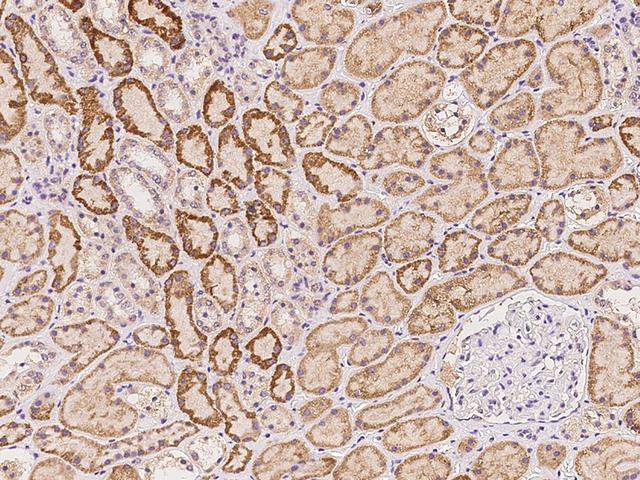 SIDT1 Antibody - Immunochemical staining of human SIDT1 in human kidney with rabbit polyclonal antibody at 1:500 dilution, formalin-fixed paraffin embedded sections.