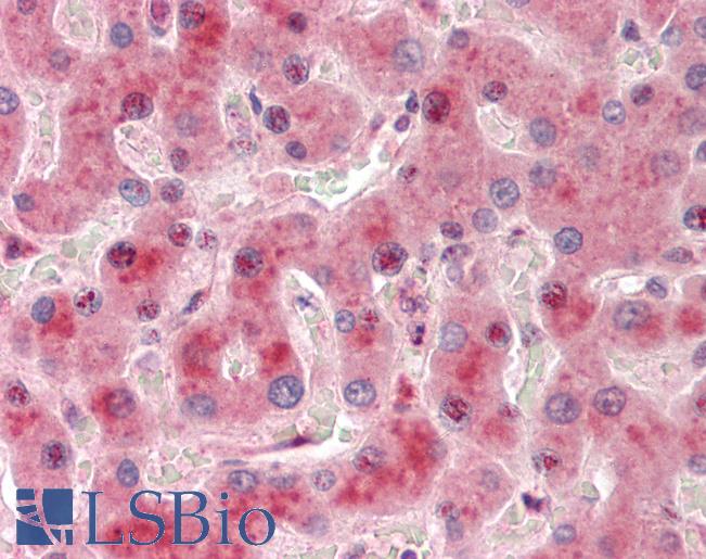 SIDT2 Antibody - Human Liver: Formalin-Fixed, Paraffin-Embedded (FFPE).  This image was taken for the unconjugated form of this product. Other forms have not been tested.