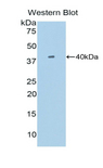 SIGIRR Antibody - Western blot of recombinant SIGIRR.  This image was taken for the unconjugated form of this product. Other forms have not been tested.