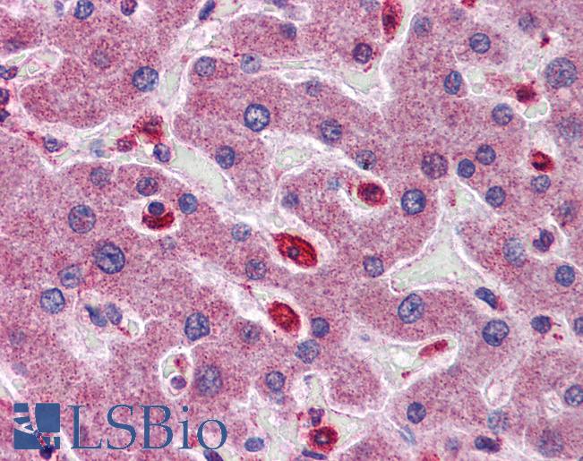 SIGIRR Antibody - Anti-SIGIRR antibody IHC of human liver. Immunohistochemistry of formalin-fixed, paraffin-embedded tissue after heat-induced antigen retrieval. Antibody concentration 5 ug/ml.  This image was taken for the unconjugated form of this product. Other forms have not been tested.