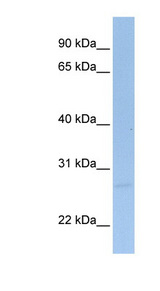 SIGIRR Antibody - SIGIRR antibody Western blot of Jurkat lysate. This image was taken for the unconjugated form of this product. Other forms have not been tested.