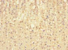 SIGIRR Antibody - Immunohistochemistry of paraffin-embedded human adrenal gland tissue at dilution 1:100