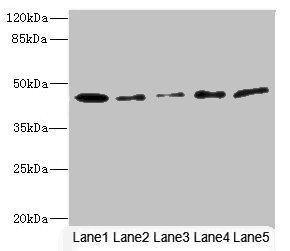 SIGIRR Antibody - Western blot All Lanes: SIGIRR antibody at 1.77ug/ml Lane 1: Mouse liver tissue Lane 2: Mouse kidney tissue Lane 3: Jurkat whole cell lysate Lane 4: MCF7 whole cell lysate Lane 5: HepG-2 whole cell lysate Secondary Goat polyclonal to rabbit IgG at 1/10000 dilution Predicted band size: 46,56 kDa Observed band size: 46 kDa