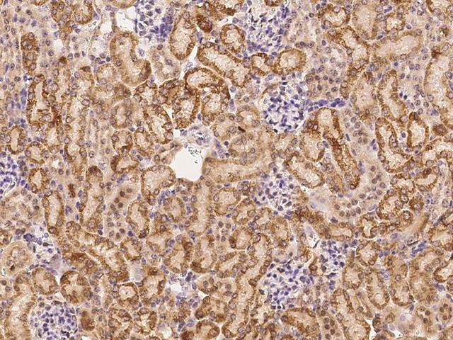 SIGIRR Antibody - Immunochemical staining SIGIRR in mouse kidney with rabbit polyclonal antibody at 1:300 dilution, formalin-fixed paraffin embedded sections.