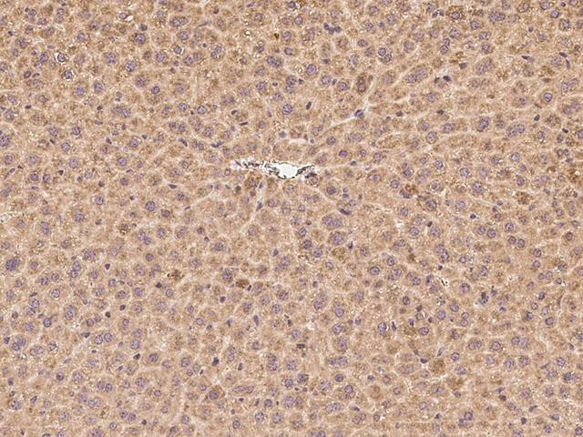 SIGIRR Antibody - Immunochemical staining SIGIRR in mouse liver with rabbit polyclonal antibody at 1:300 dilution, formalin-fixed paraffin embedded sections.
