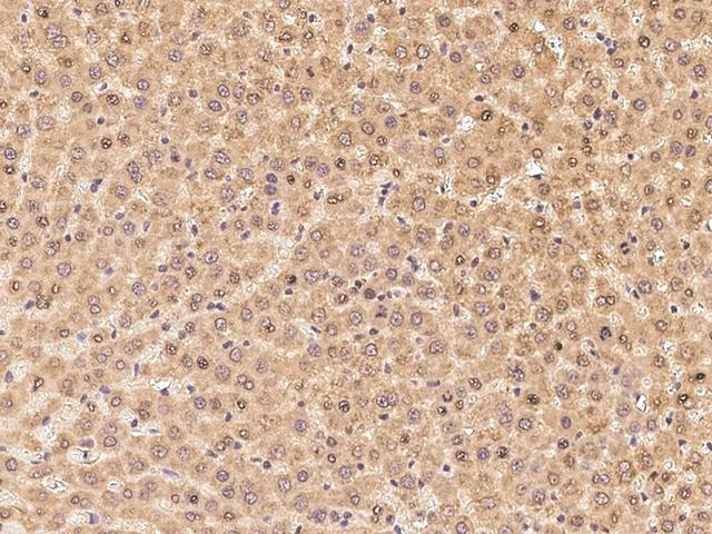 SIGIRR Antibody - Immunochemical staining SIGIRR in rat liver with rabbit polyclonal antibody at 1:300 dilution, formalin-fixed paraffin embedded sections.