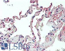 SIGLEC1 / CD169 / Sialoadhesin Antibody - Human Lung: Formalin-Fixed, Paraffin-Embedded (FFPE)