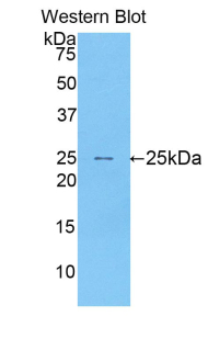 SIGLEC1 / CD169 / Sialoadhesin Antibody - Western blot of recombinant SIGLEC1 / CD169 / Sialoadhesin.  This image was taken for the unconjugated form of this product. Other forms have not been tested.