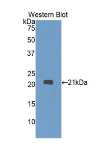 SIGLEC10 Antibody - Western blot of recombinant SIGLEC10 / SIGLEC-10.  This image was taken for the unconjugated form of this product. Other forms have not been tested.