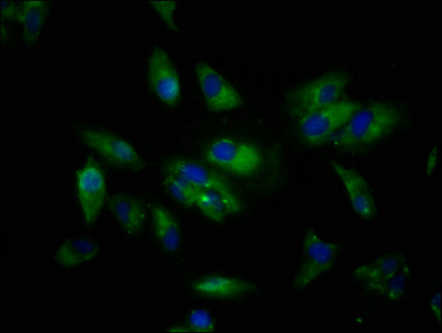 SIGLEC10 Antibody - Immunofluorescence staining of Hela cells at a dilution of 1:133, counter-stained with DAPI. The cells were fixed in 4% formaldehyde, permeabilized using 0.2% Triton X-100 and blocked in 10% normal Goat Serum. The cells were then incubated with the antibody overnight at 4 °C.The secondary antibody was Alexa Fluor 488-congugated AffiniPure Goat Anti-Rabbit IgG (H+L) .