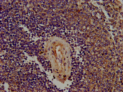 SIGLEC10 Antibody - Immunohistochemistry image at a dilution of 1:400 and staining in paraffin-embedded human spleen tissue performed on a Leica BondTM system. After dewaxing and hydration, antigen retrieval was mediated by high pressure in a citrate buffer (pH 6.0) . Section was blocked with 10% normal goat serum 30min at RT. Then primary antibody (1% BSA) was incubated at 4 °C overnight. The primary is detected by a biotinylated secondary antibody and visualized using an HRP conjugated SP system.