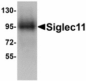 SIGLEC11 Antibody - Western blot of Siglec11 in HepG2 cell lysate with Siglec11 antibody at 1 ug/ml. Below: Immunohistochemistry of Siglec11 in human liver tissue with Siglec11 antibody at 5 ug/ml.