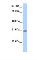 SIGLEC12 Antibody - HepG2 cell lysate. Antibody concentration: 1.0 ug/ml. Gel concentration: 12%.  This image was taken for the unconjugated form of this product. Other forms have not been tested.