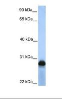 SIGLEC12 Antibody - HepG2 cell lysate. Antibody concentration: 1.0 ug/ml. Gel concentration: 12%.  This image was taken for the unconjugated form of this product. Other forms have not been tested.