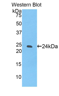 SIGLEC12 Antibody - Western blot of recombinant SIGLEC12 / SIGLEC-12.  This image was taken for the unconjugated form of this product. Other forms have not been tested.