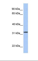 SIGLEC12 Antibody - Jurkat cell lysate. Antibody concentration: 1.0 ug/ml. Gel concentration: 12%.  This image was taken for the unconjugated form of this product. Other forms have not been tested.