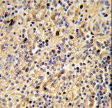 SIGLEC12 Antibody - Formalin-fixed and paraffin-embedded human spleen tissue reacted with SIGLEC12 Antibody , which was peroxidase-conjugated to the secondary antibody, followed by DAB staining. This data demonstrates the use of this antibody for immunohistochemistry; clinical relevance has not been evaluated.