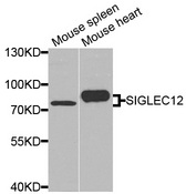 SIGLEC12 Antibody - Western blot analysis of extracts of various cells.